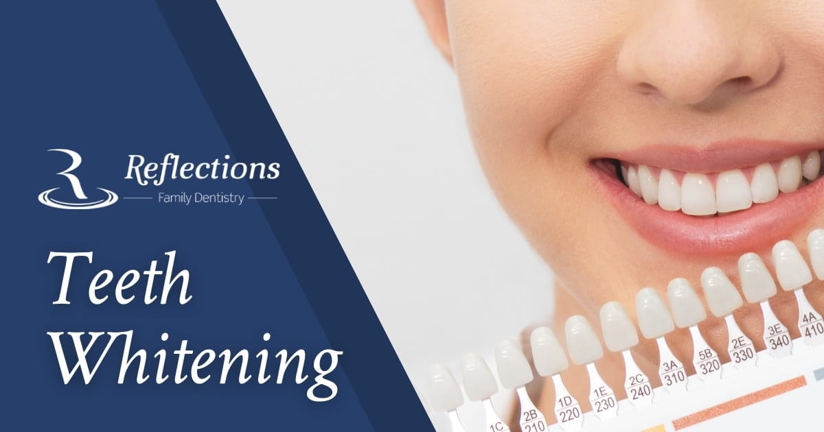 Teeth Whitening — Reflections Family Dentistry — Granite Bay, CA