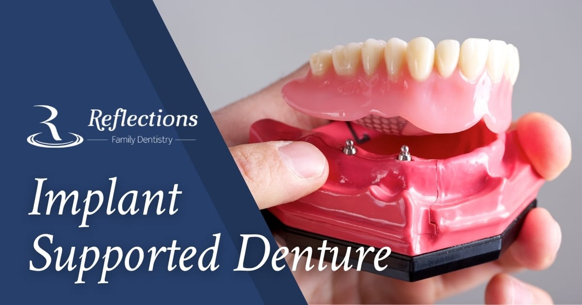 Implant Supported Dentures — Reflections Family Dentistry — Granite Bay, CA