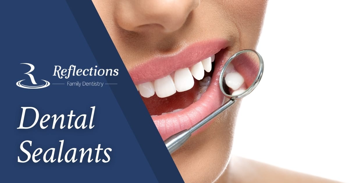 Dental Sealants — Reflections Family Dentistry — Granite Bay, CA