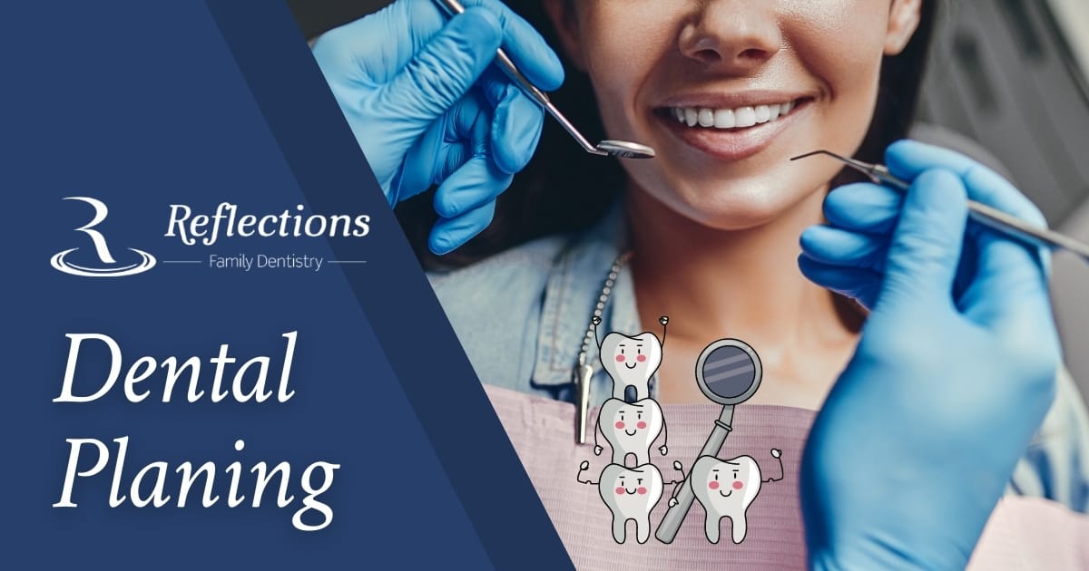 Root Planing Procedure — Reflections Family Dentistry — Granite Bay, CA